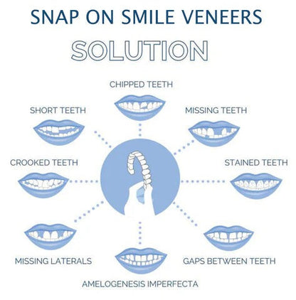 Removable Smile Veneers for Upper and Lower Teeth