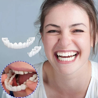 Removable Smile Veneers for Upper and Lower Teeth