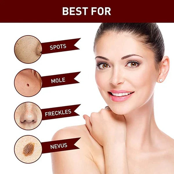 Skin Tag and Mole Appearance Cosmetic Oil