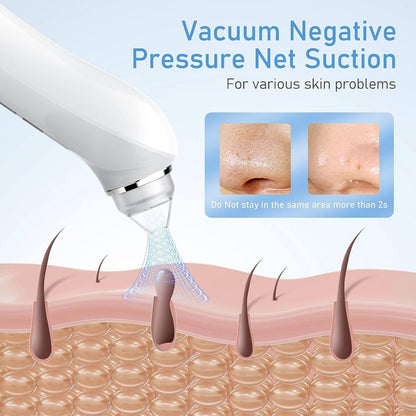 Blackhead Remover Vacuum with Camera, USB Interface Type Pore Vacuum, Black Head Extractions Tool